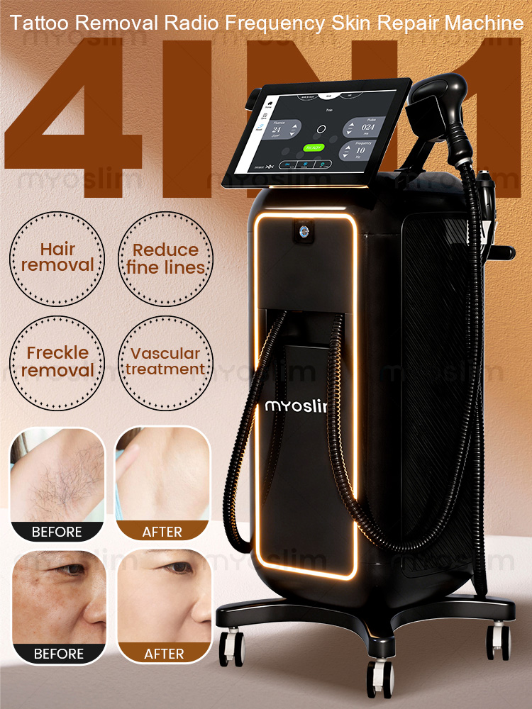Industrial Laser Hair Removal Machine - Mesin Penghilang Bulu Tanpa Rasa Sakit